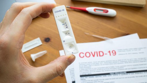 Началось добровольное тестирование сотрудников на COVID. Государство обещает компенсировать затраты