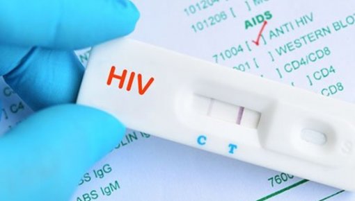 Стали доступны экспресс-тесты для самодиагностики ВИЧ