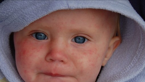 ������� ���� �������� �������: ���������������� ����� ������