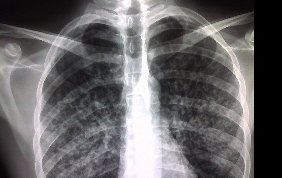 ������ ����� �����, ������� ������������