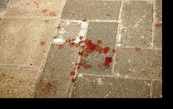 �� ��������� ������ ������� ������ 17-������� �����