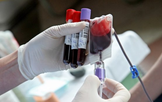 ��-�� �������� ������� ��������� ���������� ������ �����