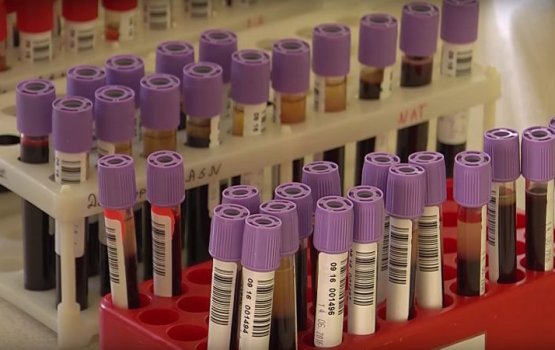 � ����������� �������� ���� ������