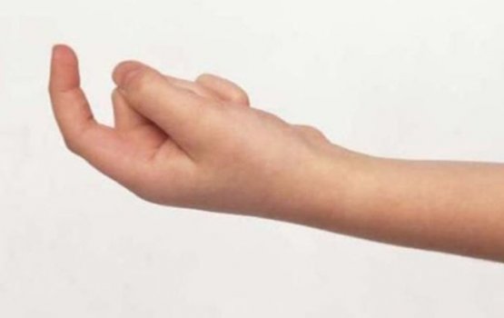 � ������� NVA ������������ ��������� �����������?