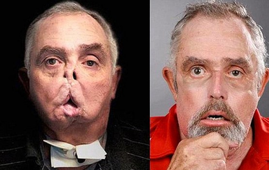 ��������������� �������� ���������� ����� ����