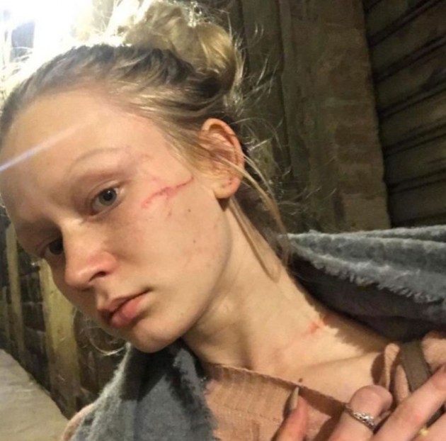 «Ударили по лицу и кормили гнилыми яблоками». Даугавпилчанка об изнанке конкурса красоты