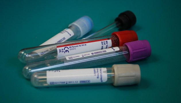 Переболели или нет? Начато тестирование на антитела COVID-19