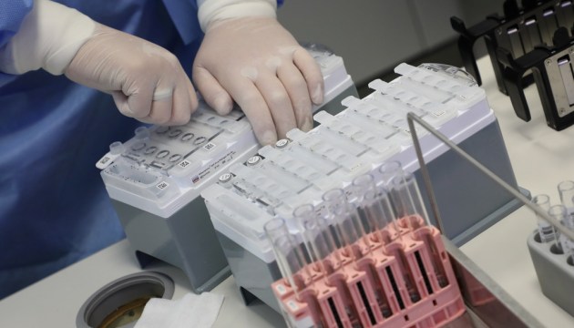 Лабораториям не хватает работников для тестирования на covid-19