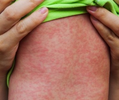 ������ � ����� � �������� �������� COVID-19