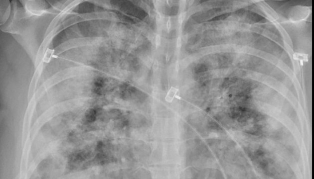 ������ ���������������� � ������������������, ������������� Covid-19: � ��� �������?