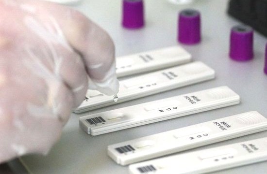 Экспресс-тесты на Covid-19 для работающих очно будет добровольным