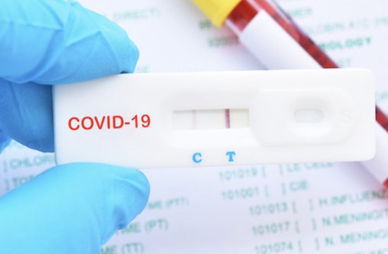 ������ Covid � ������� �������-�����, ���-���� ������� ������ �� ����