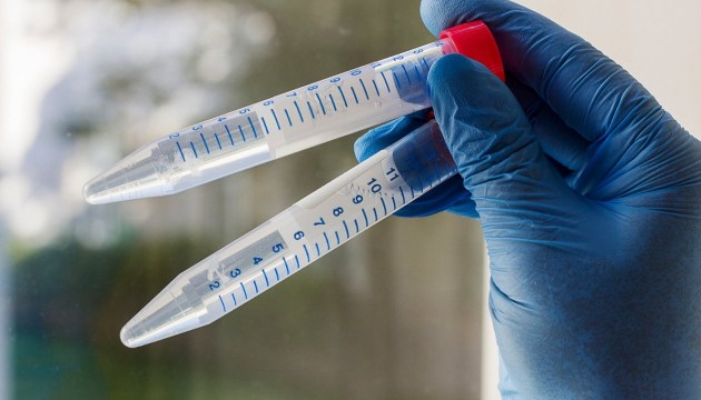 ������� �� �������� ���� �� ������ ������� COVID ������?