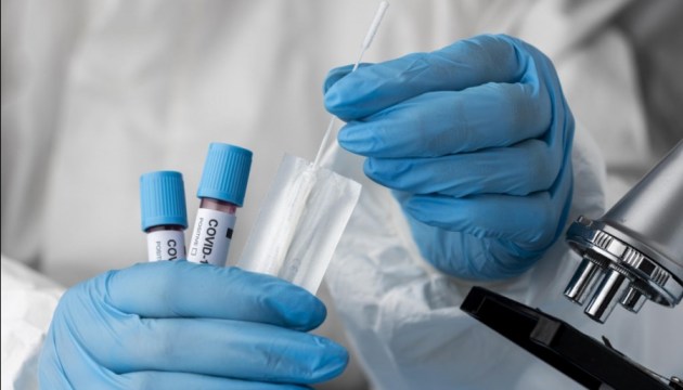 ����� ���: ��������� � Covid-19 ����� 90% ��������� �������