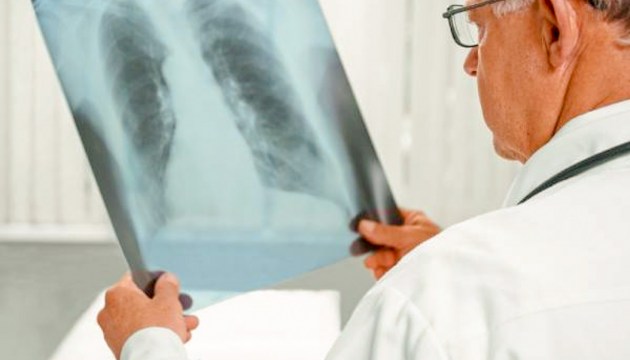 ������� � ����������� ����� ��������� ��������� ����� �� ���������