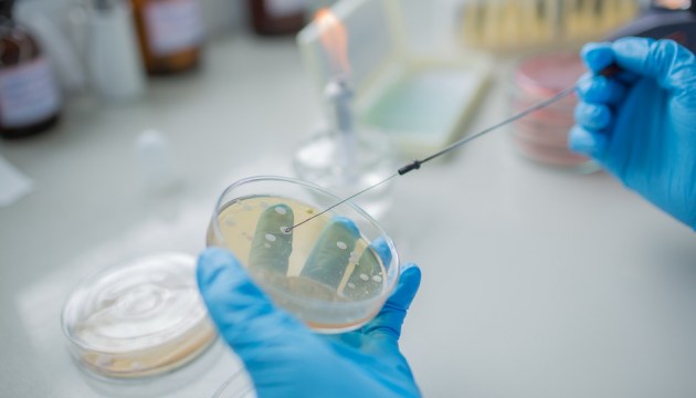 ��������� ������� �������� �������� E.coli: ��� �������� �� ������ ������