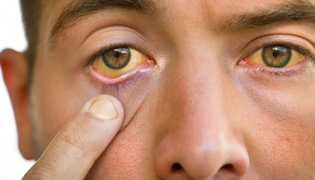 ���������, �������: ������ ���������� ��� ����������������