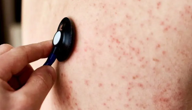 ������ ��������������� ����: ���������� ���� �� ��������� ���������� � SPKC